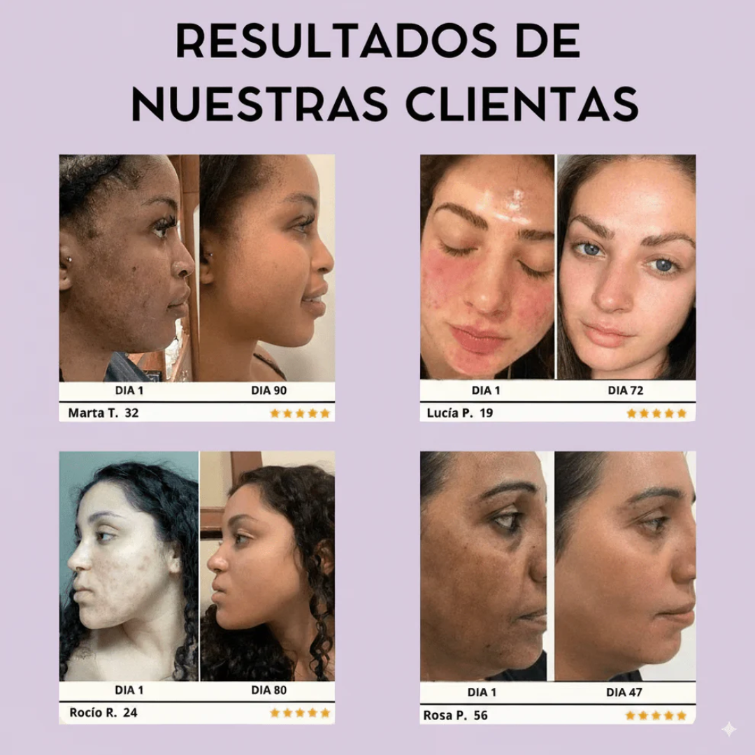 Sérum anti-edad que rejuvenece tu piel en solo 4 semanas
