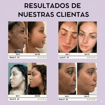 Sérum anti-edad que rejuvenece tu piel en solo 4 semanas